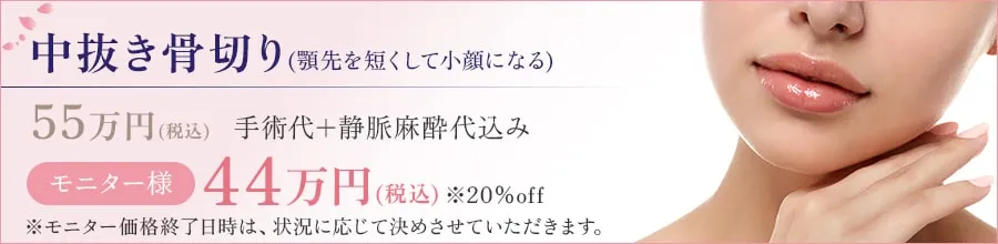 中抜き骨切り(顎先を短くして小顔になる) 55万円(税込) 手術代+静脈麻酔代込み モニター様:44万円(税込) ※20%off